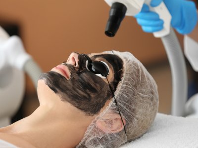 Hollywood Peel