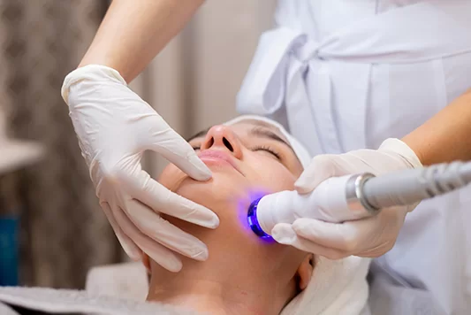 Radiofrecuencia Facial